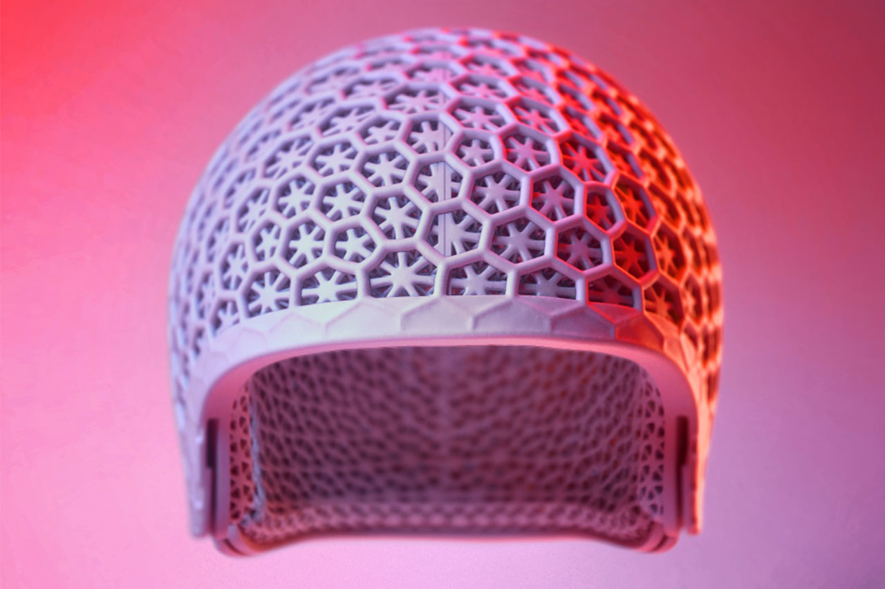 3D-generierter orthopädischer Helm mit sternförmigem Gittermuster, frontal